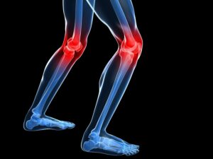 Physical Therapy Catasauqua PA - How Long Does It Take to Heal From Knee Replacement Surgery?